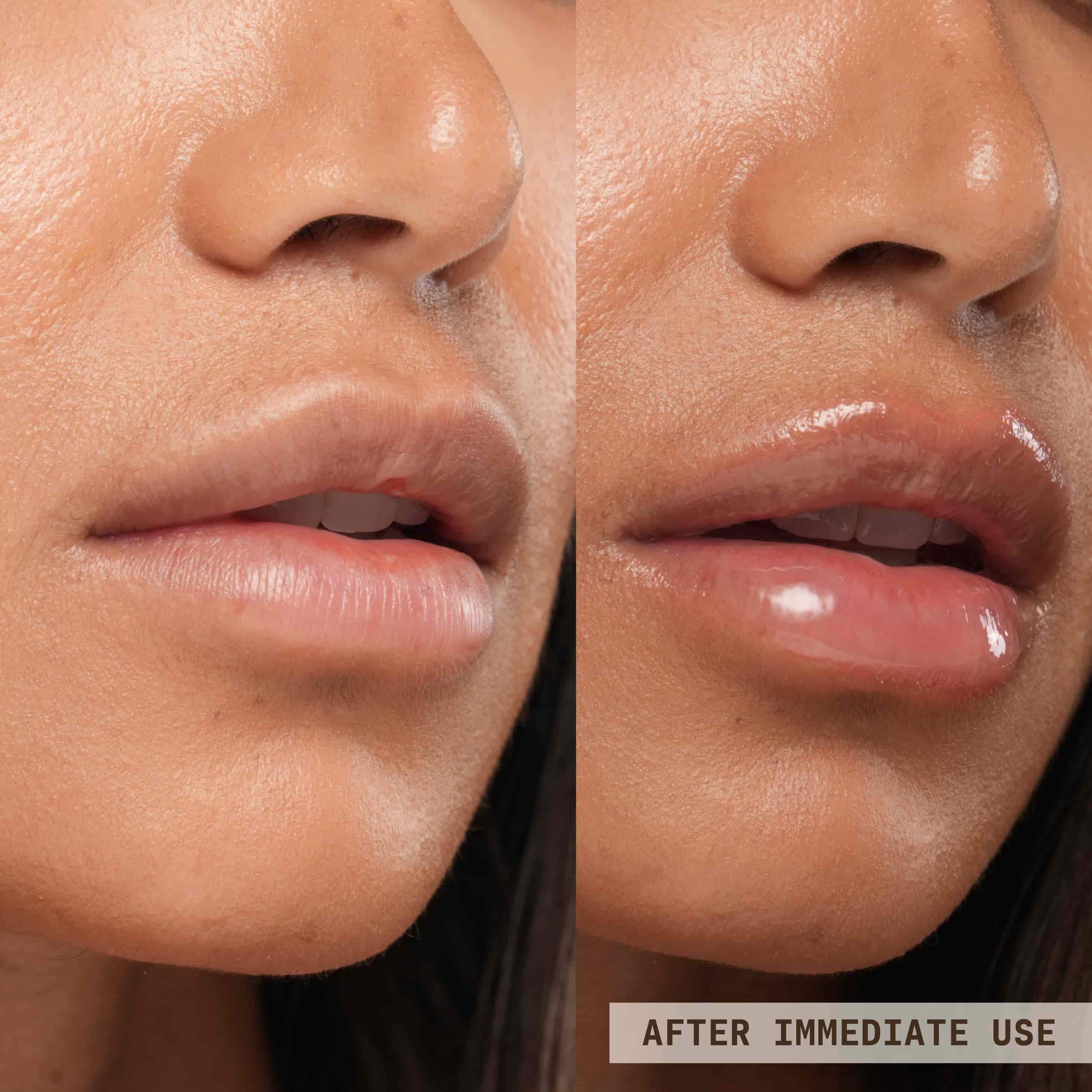 Dewy Lip Treatment